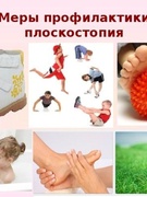 ПРОФИЛАКТИКА ПЛОСКОСТОПИЯ