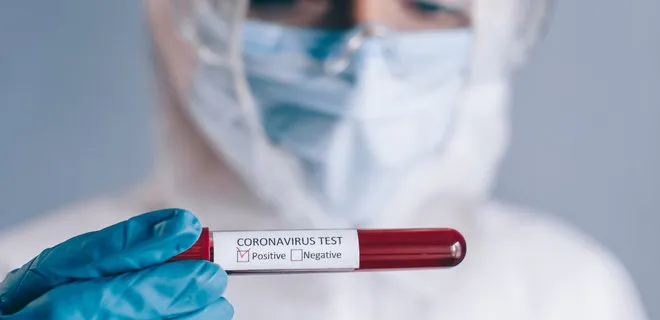 За сутки в Беларуси зарегистрированы 1378 пациентов с COVID-19, выписаны 1447