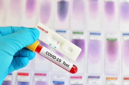 В Беларуси зарегистрировано 24 873 человека с положительным тестом на COVID-19