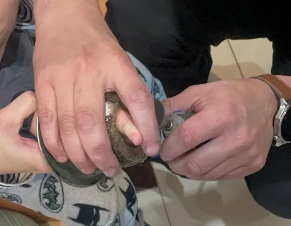 В Мозыре спасатели пришли на помощь ребенку, палец которого застрял в раковине