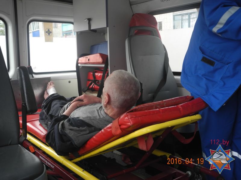 В Гомеле благодаря бдительной соседке спасен курящий пенсионер