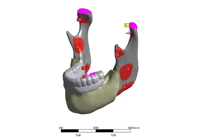 Белорусские ученые работают над 3D-моделью челюсти для корректной установки имплантатов