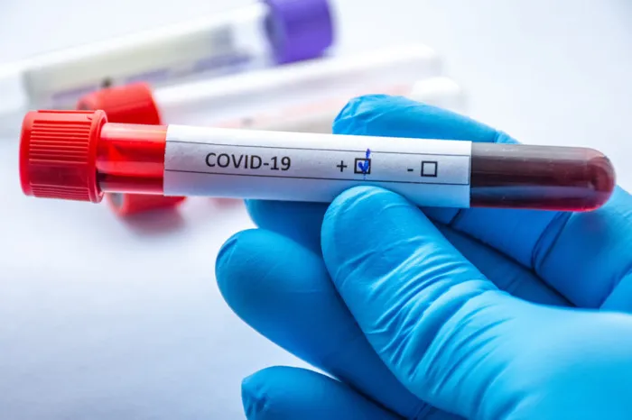 За сутки в Беларуси зарегистрированы 605 пациентов с COVID-19, выписаны 262