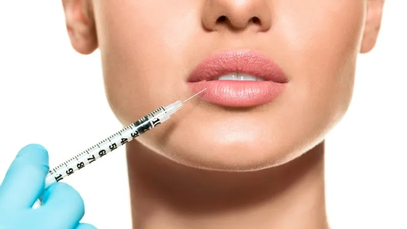 Укус пчелы, гиалуроновые усы или бабушкины вареники… Какие губы сегодня в моде?