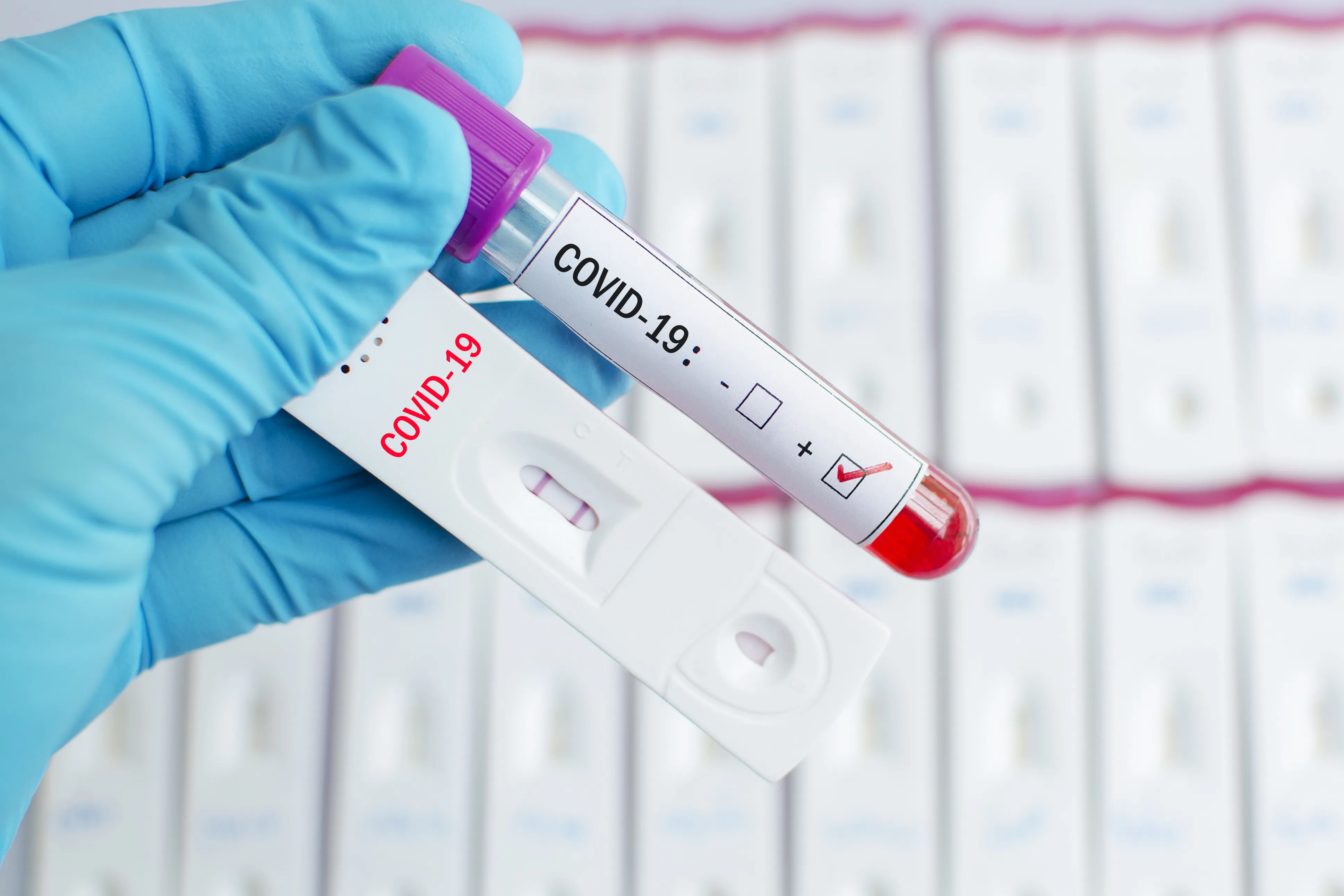 За сутки в Беларуси зарегистрированы 1166 пациентов с COVID-19, выписаны 1287