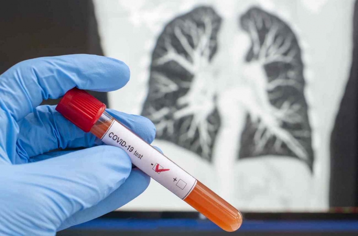 коронавирус covid_virus_01.jpg