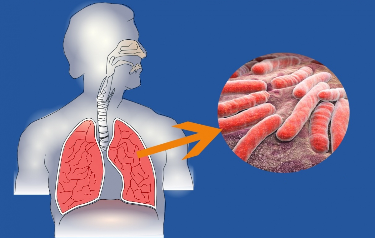 tuberculos.jpg