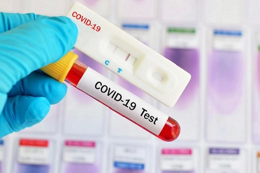 тест на коронавирус ratusan-ribu-alat-rapid-test-corona-masuk-indonesia-ini-cara-kerjanya-1584706581.jpg