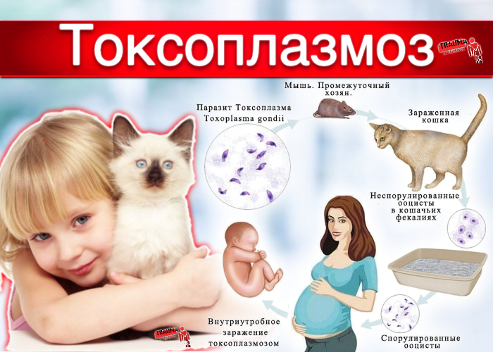 токсоплазмоз-1.jpg токсоплазмоз-1.jpg