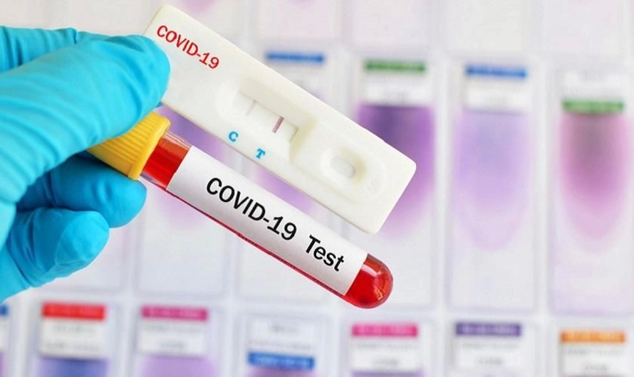 ratusan-ribu-alat-rapid-test-corona-masuk-indonesia-ini-cara-kerjanya-1584706581.jpg