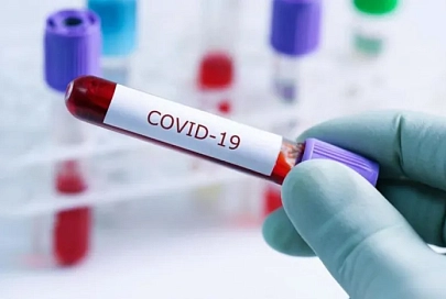 За сутки в Беларуси зарегистрированы 189 пациентов с COVID-19, выписан 21