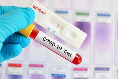 За сутки в Беларуси зарегистрированы 579 пациентов с COVID-19, выписаны 236