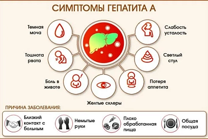 Вирусный гепатит А.  Что надо знать, чтобы не заболеть