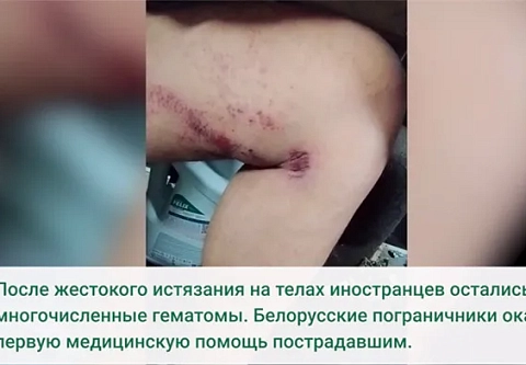 Еще двое беженцев подверглись жестокости латвийских силовиков