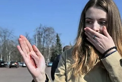 Акцию «Оказание первой помощи — спасение жизни» провели на площиди Ленина сотрудники ГАИ и представители Красного Креста