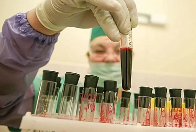 В Беларуси зарегистрировано более 21 тысячи случаев ВИЧ-инфекции