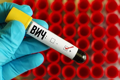В прошлом году на Гомельщине выявили 659 новых случаев заболевания ВИЧ-инфекцией