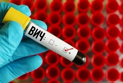 За два месяца 2020 года на Гомельщине выявлено 120 новых случаев ВИЧ