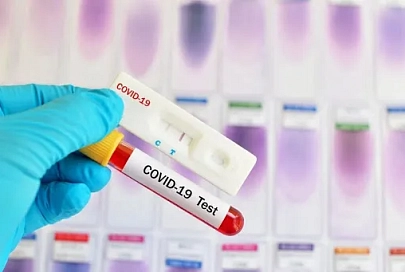В Беларуси зарегистрировано 24 873 человека с положительным тестом на COVID-19