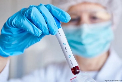 В Беларуси зарегистрированы 69 тыс. 424 человека с положительным тестом на COVID-19
