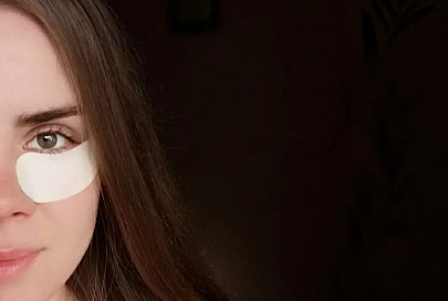 Темные круги под глазами не всегда указывают на недосып