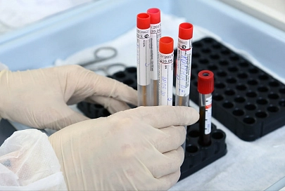 Частные лаборатории смогут проводить ПЦР-исследования на SARS-CoV-2 для системы здравоохранения