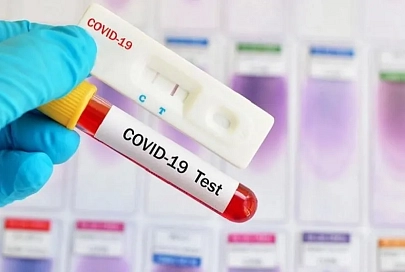 За сутки в Беларуси зарегистрированы 1 073 пациентов с COVID-19, выписаны - 852 пациента