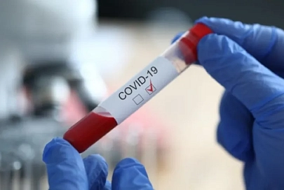 За сутки в Беларуси зарегистрированы 1318 пациентов с COVID-19, выписаны 1393 человека