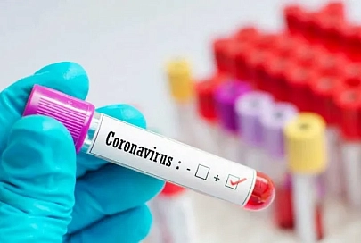 За сутки в Беларуси зарегистрированы 1378 пациентов с COVID-19, выписаны 1303